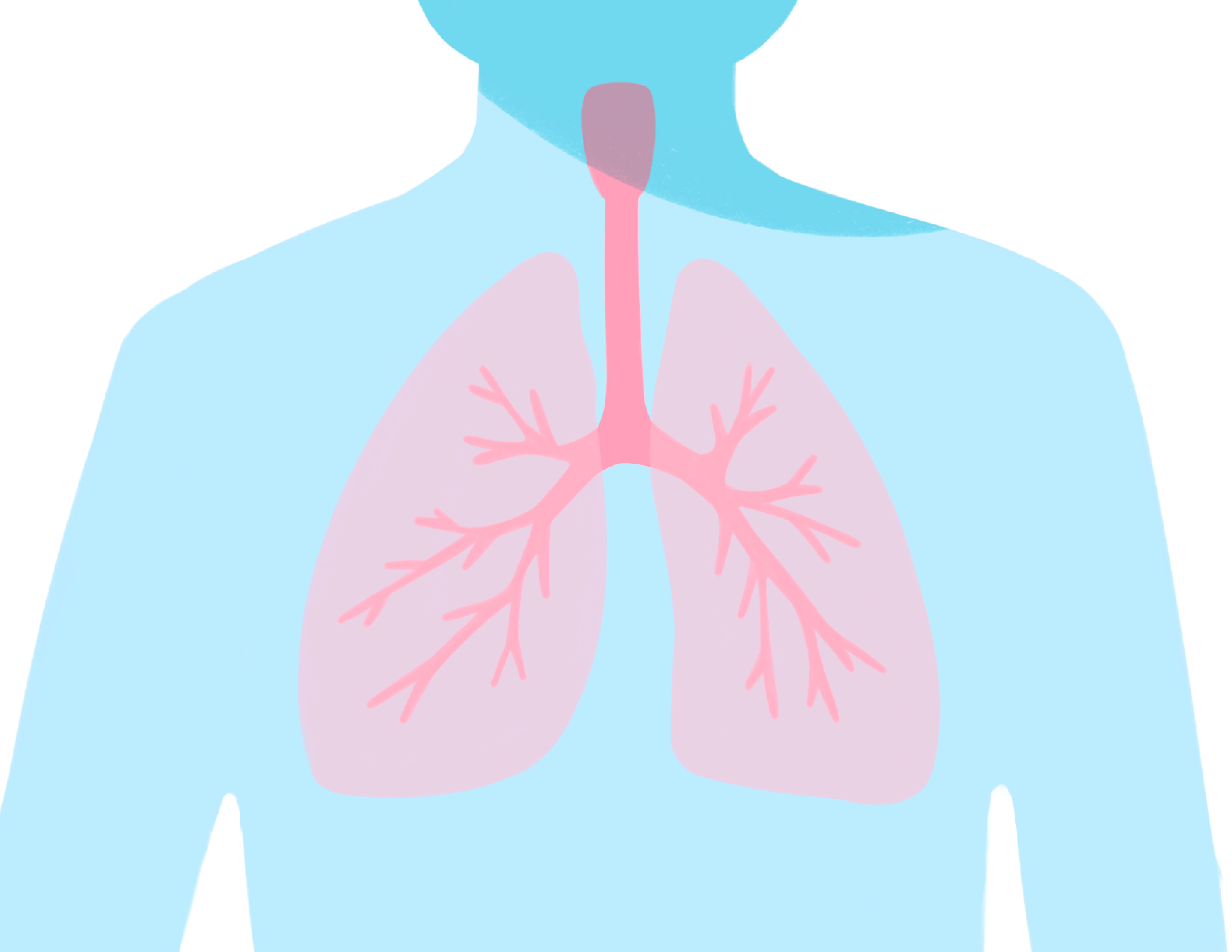 Lung Cancer SBRT