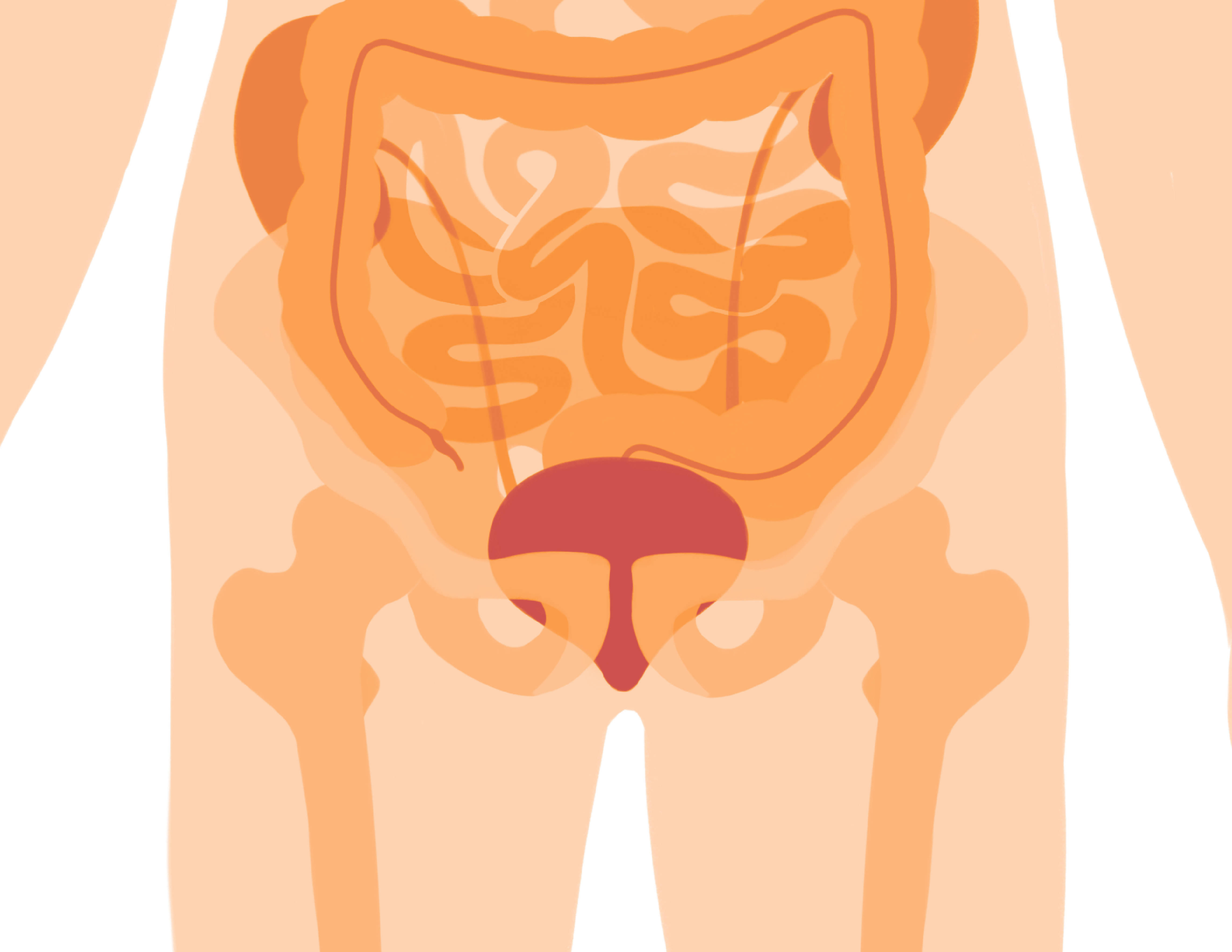 Pelvic Cancer SBRT