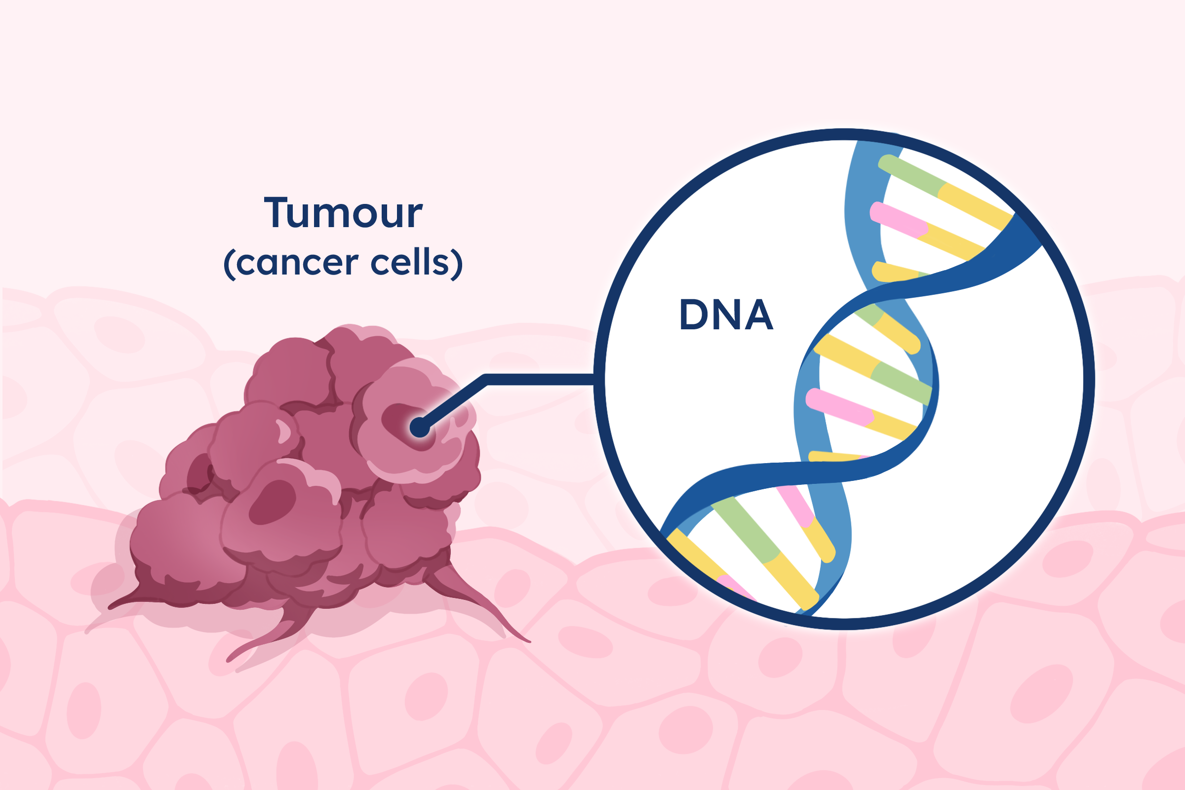 Diagram showing radiation entering a cancer cell and starting to damage its DNA.