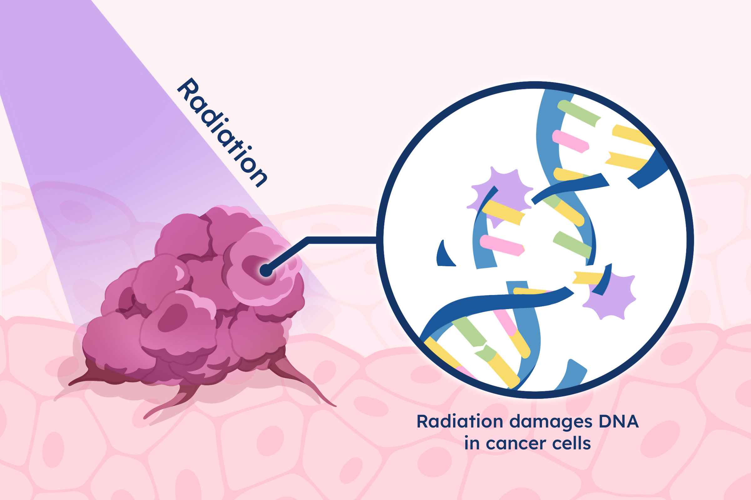 Diagram showing damaged cancer cells no longer able to grow and divide.